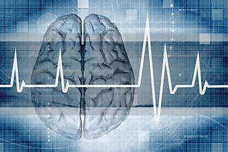 Brain Monitor