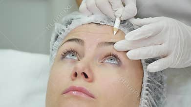 Doctor draw lines with marker on patient face for facial plastic surgery at clinic