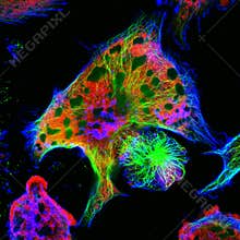 Real fluorescence microscopic view of mice neuroblastoma cell line