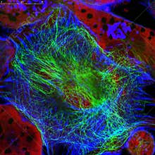 Real fluorescence microscopic view of mice neuroblastoma cell line