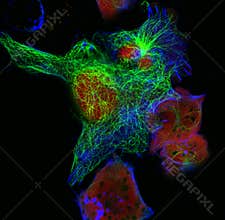 Real fluorescence microscopic view of mice neuroblastoma cell line