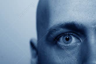 Insane eye