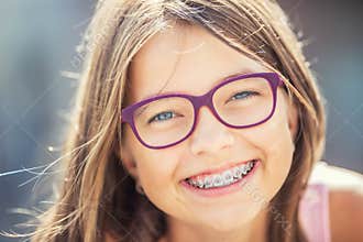 Happy smiling girl with dental braces and glasses. Young cute caucasian blond girl wearing teeth braces and glasses