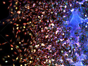 Real fluorescence microscopic view of cancer cells - human brain