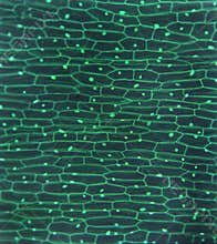 Onion skin microscopic