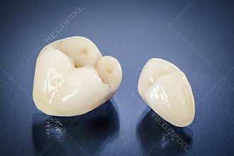Metal free ceramic dental crowns