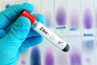 Zika virus positive