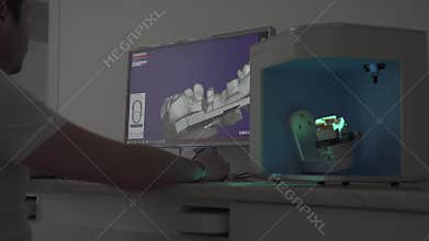 3D dental digital modeling restoration. Dentist's high tech equipment at work