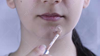 Skin care. Young woman apply concealer on a pimple. Mask acne. Problem skin, acne, redness, blemishes, spots, blackheads, cosmetol