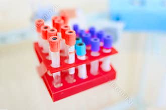Laboratory test tubes with tests for research.