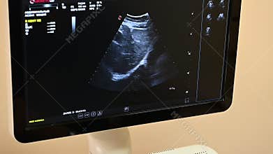 The doctor makes an ultrasound to the patient and examines the organs on the monitor