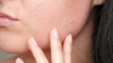 Skin texture with enlarged pores. Close-up of a woman`s face.