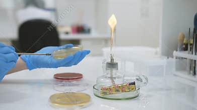 Bacteriological crops of various bacteria and microorganisms are produced by the lab staff in gloves.
