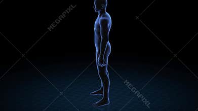 Man with pathology. 3d body of boy. Male human figure