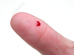 Cut Finger