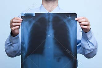 Chest x-ray