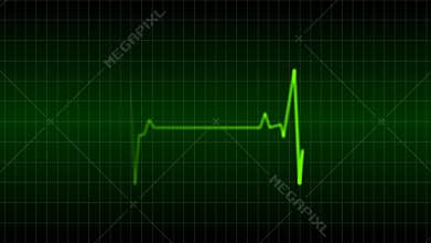 Heart monitor EKG animation