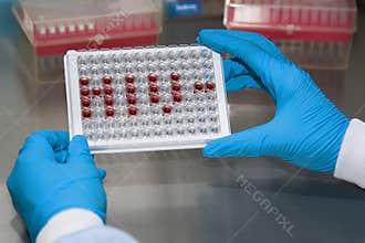 Microplate for ELISA with HIV abbreviation