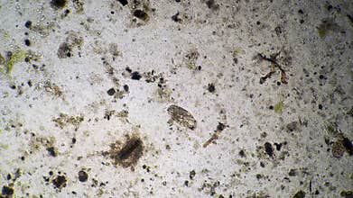 Surveillance infusoria Stylonychia mytilus floating in a large cluster of bacteria