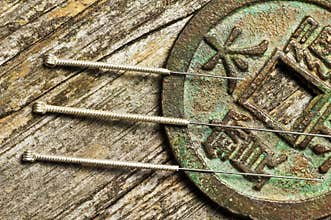 Acupuncture needles