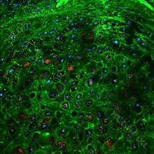 Cells under fluorescence microscope