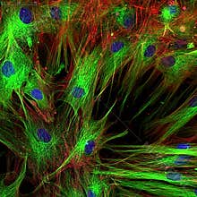 Fibroblasts (skin cells) labeled with fluorescent