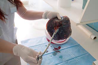 Healthy human placenta shortly after birth