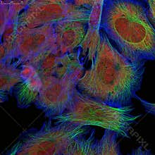 Fibroblasts (skin cells) labeled with fluorescence dyes