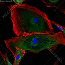Fibroblasts (skin cells) labeled with fluorescence dyes