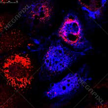 Fibroblasts (skin cells) labeled with fluorescent dyes