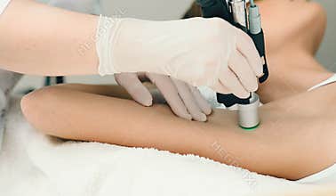 A patient getting laser treatment on armpit, close up. Laser hair removing on armpit