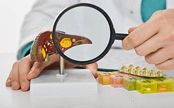 Human liver disease, diagnosis and liver treatment. Doctor showing liver anatomical model, cirrhosis and