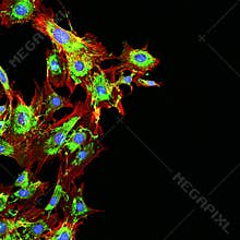 Imaging of metastatic cancer cells