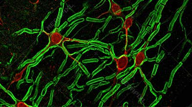 Oligodendrocyte Myelin Sheath Morphology Confocal Brain Slice
