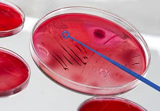 INOCULATION MICROBIOLOGY