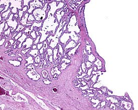 Human seminal vesicle