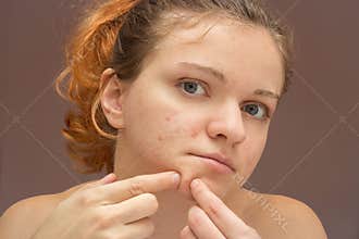 portrait of young beautiful woman squeezing acne or pimple isolated