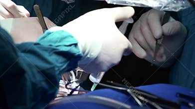 Surgical teamwork,surgeon`s hands