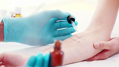 Doctor doing skin test at his patient