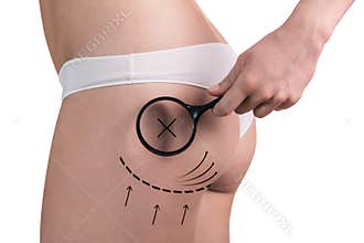 Body correction with the help of plastic surgery