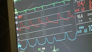 Monitor with vital signs (2 of 2)