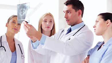 Group of doctors with x-ray prints