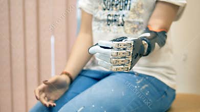 An amputee woman demonstrates her bionic hand. 4K.