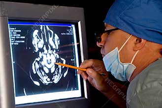 Brain Scan
