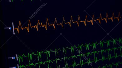 Medical heart monitor measuring ecg.