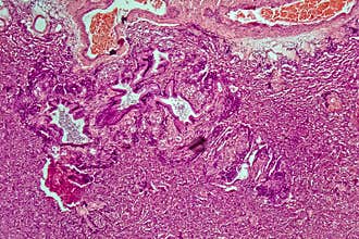Cross-section of rat normal lung tissue, 60x zoom