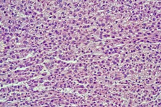 Microscope photo of a section through a rat liver, 60x zoom