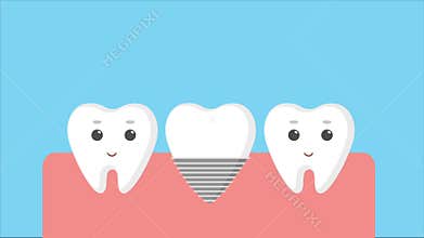 Cartoon gums with white teeth.
