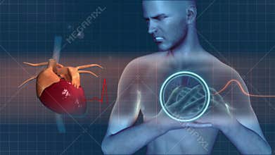 Heart attack. Animation of pain in the heart.