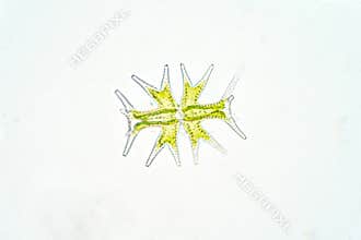 Micrasterias is a unicellular green algae under the microscope view